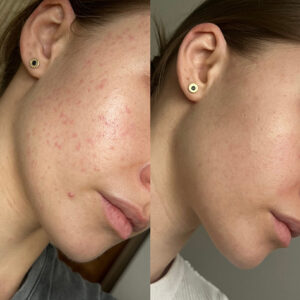 Obraz 4.08.2025, godz. 08.25 (1)