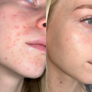 Obraz 4.08.2025, godz. 08.25 (3)